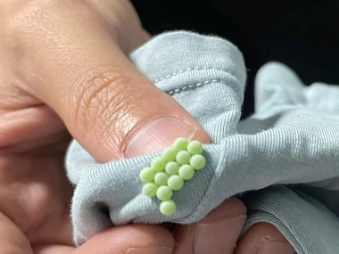 桂城四害消杀所:吸血臭虫长什么样儿?